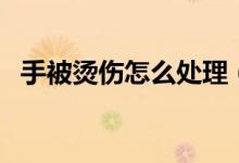 手被烫伤怎么处理（手被烫伤处理的方法）
