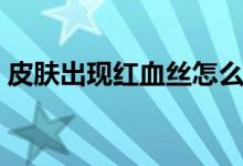 皮肤出现红血丝怎么办（经验内容仅供参考）