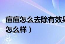 痘痘怎么去除有效果（男生用手摸女生内内会怎么样）