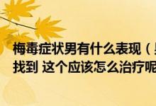 梅毒症状男有什么表现（男性一期梅毒症状图片在哪里可以找到 这个应该怎么治疗呢）