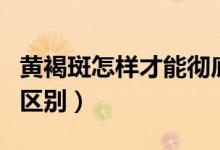 黄褐斑怎样才能彻底的去掉（黄褐斑和雀斑的区别）