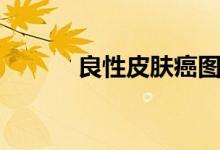 良性皮肤癌图片(皮肤癌图片)