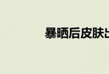 暴晒后皮肤出现白斑（暴晒）