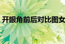 开眼角前后对比图女生（开眼角前后对比图）